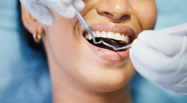 Best Pediatric Emergency Dentist in Hopewell, VA
