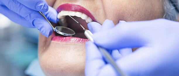 Best Emergency Tooth Extraction in Hopewell, VA